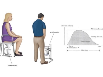 uroflowmetry